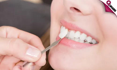 Dental Crowns & Veneers!